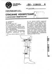 Протез бедра (патент 1138151)