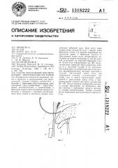 Способ чрескожной чреспеченочной микрохолецистостомии (патент 1318222)