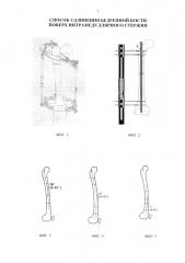 Способ удлинения бедренной кости поверх интрамедуллярного стержня (патент 2638279)