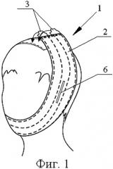 Фиксатор для раневых покрытий (варианты) (патент 2546455)