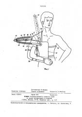 Устройство для вправления вывиха плеча (патент 1421335)