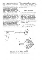 Устройство для электростимуляциирецепторов шейки матки (патент 829117)
