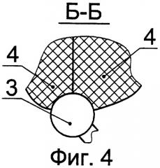 Устройство плечевого соединения игровых фигурок (патент 2307693)