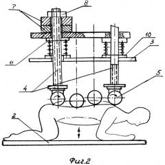 Устройство для коррекции мышечного дисбаланса (патент 2399398)