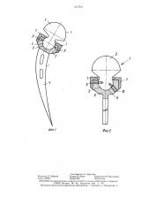 Эндопротез тазобедренного сустава (патент 1417871)
