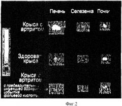 Лечение и диагностика заболеваний, опосредованных макрофагами (патент 2480241)