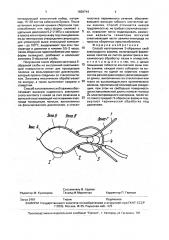 Зажим для крепления электродов экг (патент 1828744)
