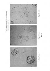 Способ микроинкапсулирования стволовых клеток (патент 2618435)