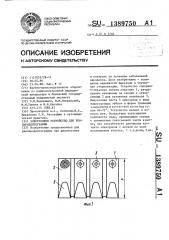 Электродное устройство для реопародонтографии (патент 1389750)