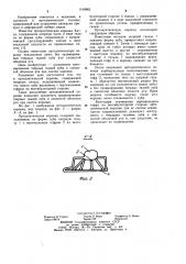 Ортодонтическая коронка (патент 1149963)