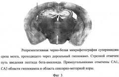 Комбинация для коррекции неврологического и психоэмоционального статуса при органических нарушениях цнс (патент 2536270)