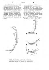 Игла хирургическая (патент 862935)