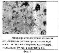 Способ лечения больных с глубоким кариесом зубов (патент 2286816)