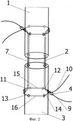 Способ наложения сухожильного шва (патент 2393807)