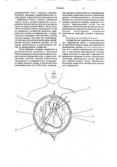 Устройство для крепления концов лигатуры (патент 1736446)