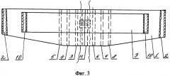 Ортопедический корсет для лечения спондилолистеза (патент 2307627)