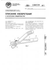 Устройство для внутриглазных операций (патент 1360728)