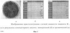 Способ дифференциальной диагностики инфекционно-воспалительных осложнений при травме глаза (патент 2356053)