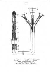 Устройство для кардиодилятации (патент 995751)