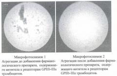 Способ исследования агрегации тромбоцитов (патент 2421724)