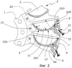Способ сборки рабочего колеса ковшовой турбины (патент 2249719)