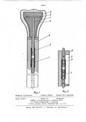 Система крепления эндопротеза трубчатой кости (патент 590872)