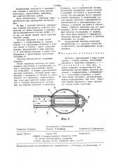 Катетер (патент 1319861)