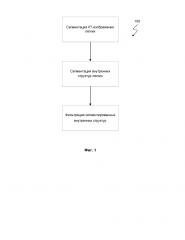 Способ и система сегментации изображений очагов легких (патент 2656761)