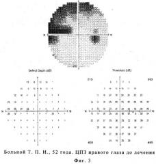 Способ терапевтического лечения первичной открытоугольной глаукомы (патент 2244528)