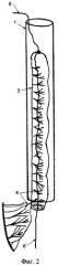 Способ проведения кишечного аутотрансплантата на сосудистой ножке в зону проекции пищевода и трахеи (патент 2372857)