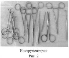 Способ овариогистерэктомии кошек по боковому доступу (патент 2396923)