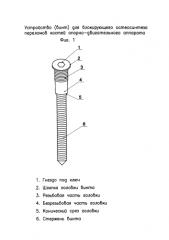 Устройство (винт) для блокирующего остеосинтеза переломов костей опорно-двигательного аппарата (патент 2585735)