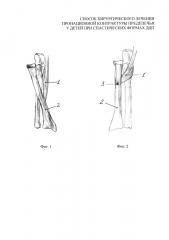 Способ хирургического лечения пронационной контрактуры предплечья у детей при спастических формах дцп (патент 2646574)