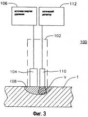 Оптический пирометрический катетер для мониторинга температуры ткани в ходе удаления сердечной ткани (патент 2479277)