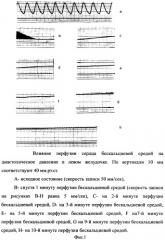 Способ измерения набухания кардиомиоцитов целого сердца при удалении са2+ из внеклеточной среды в эксперименте (патент 2368956)