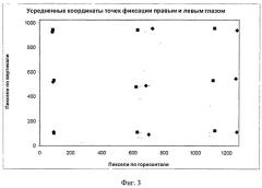 Способ диагностирования состояния глазодвигательных мышц (патент 2484760)