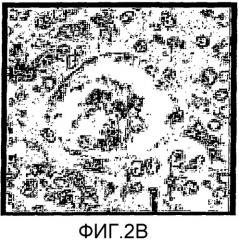 Сенсибилизированный оперативный bold-mri способ получения изображения (патент 2343829)