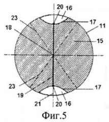 Способ хирургической коррекции пресбиопии в сочетании со смешанным астигматизмом (патент 2514876)
