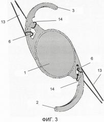 Интраокулярная линза (патент 2475211)