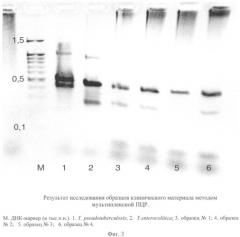 Набор родо- и видоспецифичных олигонуклеотидных праймеров для детекции и видовой идентификации иерсиний методом мультиплексной полимеразной цепной реакции (патент 2354700)