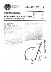 Способ стереотаксического доступа к мозговым структурам (патент 1144697)