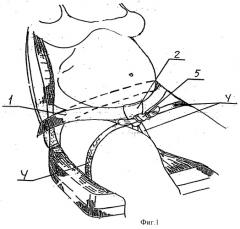 Удерживающее устройство ремня безопасности для беременных (патент 2357879)