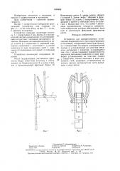 Устройство для компрессионного остеосинтеза бедренной кости при коррегирующих остеотомиях (патент 1598989)