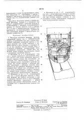 Механизм локтевого шарнира протеза (патент 281741)