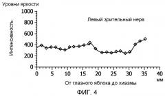 Классификация изображения на основе сегментации изображения (патент 2513905)