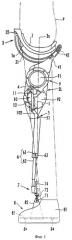 Устройство, облегчающее ходьбу (патент 2413490)