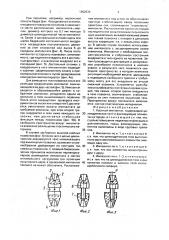 Костный имплантат (патент 1662534)