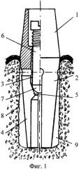 Зубной имплантат бутовского-родионова (патент 2356515)