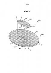 Одноплоскостный имплантат для восстановления ткани (патент 2628622)