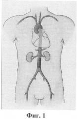 Способ хирургического лечения критической ишемии нижних конечностей у больных с тяжелой сопутствующей соматической патологией (патент 2390310)
